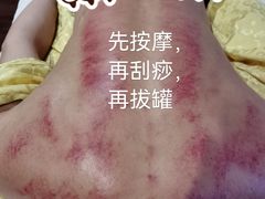 -脊艾堂推拿·艾灸(美年广场店)