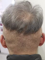 -熙朵美学植发·连锁品牌