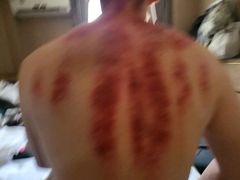 -天然沐足·推背采耳·敷姜艾灸(龙眼美食街店)