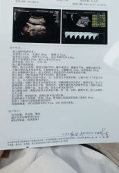 -北京安琪