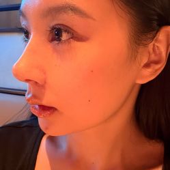 -JustHer宁波珈禾医疗美容医院