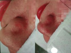 点击看大图 -苑苑vbeauty科技美容SPA