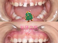 -精德口腔·种植修复·儿牙中心(财富中心店)