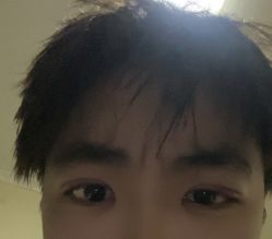 -万州华美紫馨整形美容医院