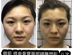 -修申骨雕小颜脊柱骨盆管理产后修复