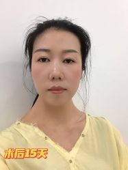 -广州美莱医疗美容医院
