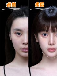 -深圳艺星医疗美容医院
