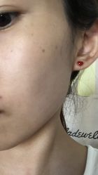 -北京楚诺医疗美容