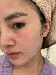 -柠檬一美·Ondapro·轻薄紧致抗衰中心