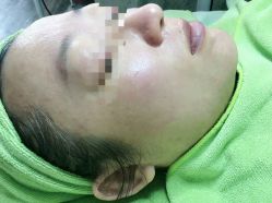 -苗医生草本科技祛痘