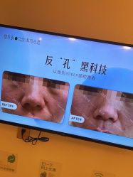-塑青春&伊肤泉祛痘皮肤管理