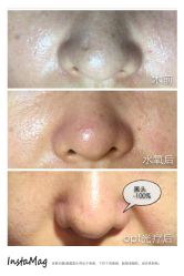 脸部抗衰-光SPA科技美肤