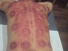 -正清和·推拿养生(黑石礁中心店)