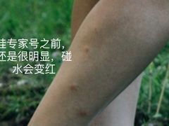 -中国人民解放军空军特色医学中心(空军总医院)