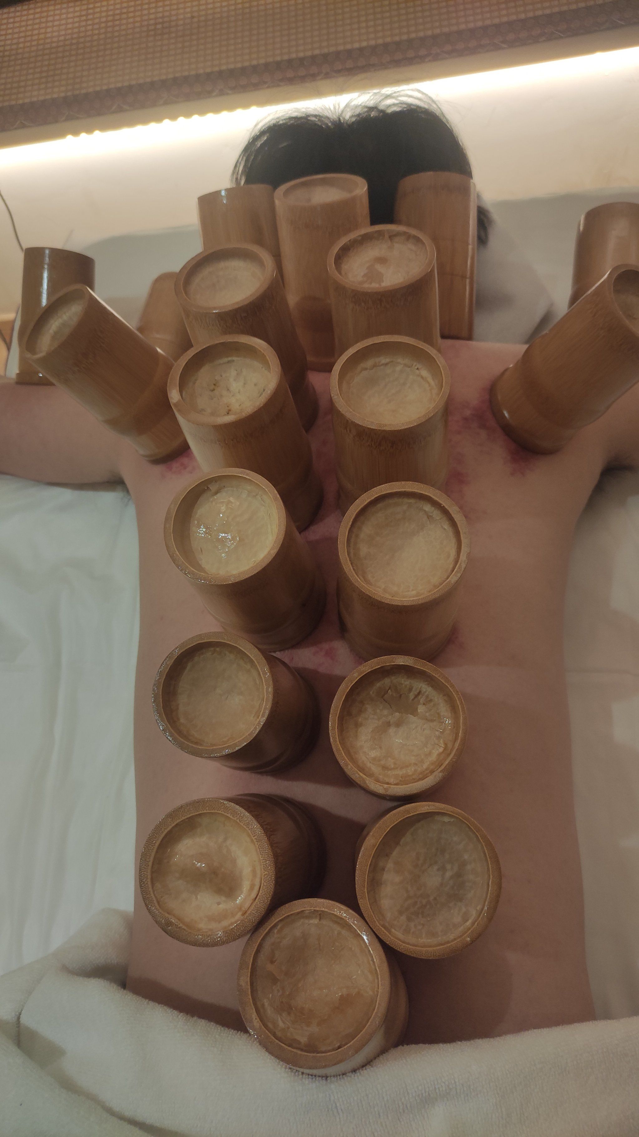 经筋疗法