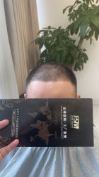 -发饰美男士增发补发假发定制店