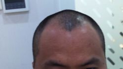 -雍禾植发全国连锁