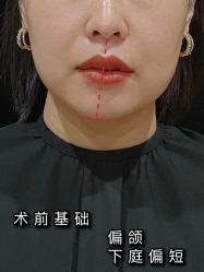 -Yestar艺星整形
