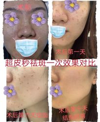 -More摩尔医美の注射线雕光电中心