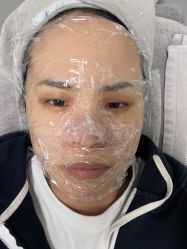 体验前-叶美人医疗美容