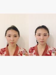 -SEAS小顏·日本小颜整骨美容サロン