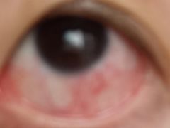 -重庆西南医院(西南院区)