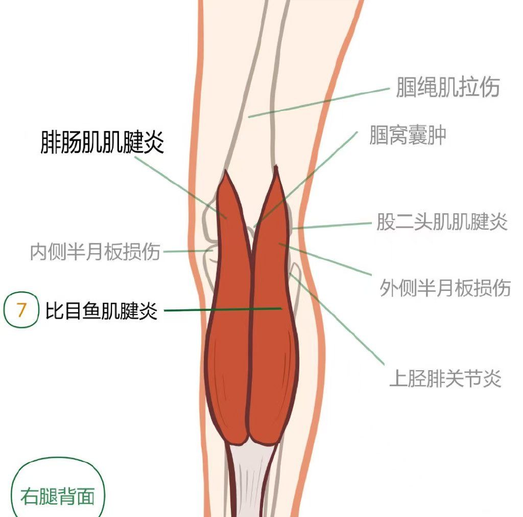 膝盖后侧疼的原因[太阳]

把这