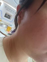 点击看大图 -广州美莱医疗美容医院