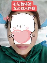 体验后-圣嘉新医疗美容医院