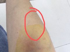 -成都市第一人民医院(南区)