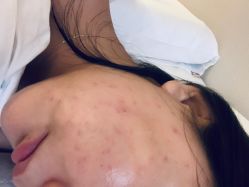 点击看大图 -小忠丽格医美