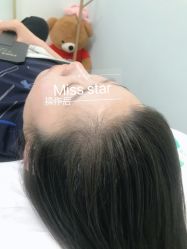 -MISS STAR·半永久纹眉·发际线·美瞳线