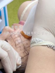 -Yestar宁波艺星整形医院