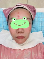 体验后-新美荟医美·专注面部美学抗衰