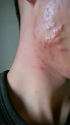 -松和日式美容整骨