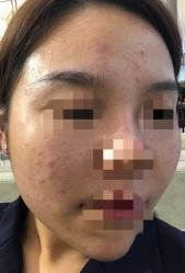 -苗医生专业祛痘·皮肤管理