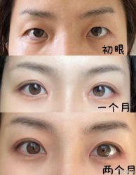 -素美医疗美容·西南眼鼻整形·修复基地