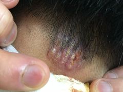 -四川天府新区人民医院