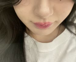 -美肤盾祛痘·问题肌头疗管理中心