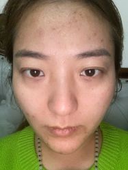 -芙贝佳禾·痘肌管理中心