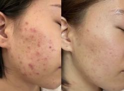 -康美贞·痘肌养护管理中心