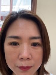 -万州华美紫馨整形美容医院