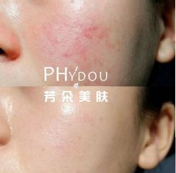 -芳朵美容养生SPA