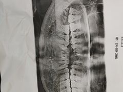 -上海仁爱医院口腔科 · 种植