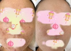 -康美贞·痘肌养护管理中心