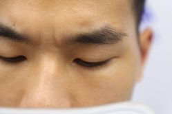 -大麦微针植发丨全国连锁