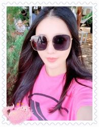 体验后-大麦微针植发全国连锁