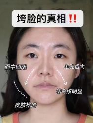 -倩极·精研痘敏肌管理