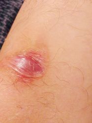 -成都军建医院·疤痕诊疗中心