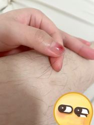 -小梨·OndaPro·专业脱毛连锁机构